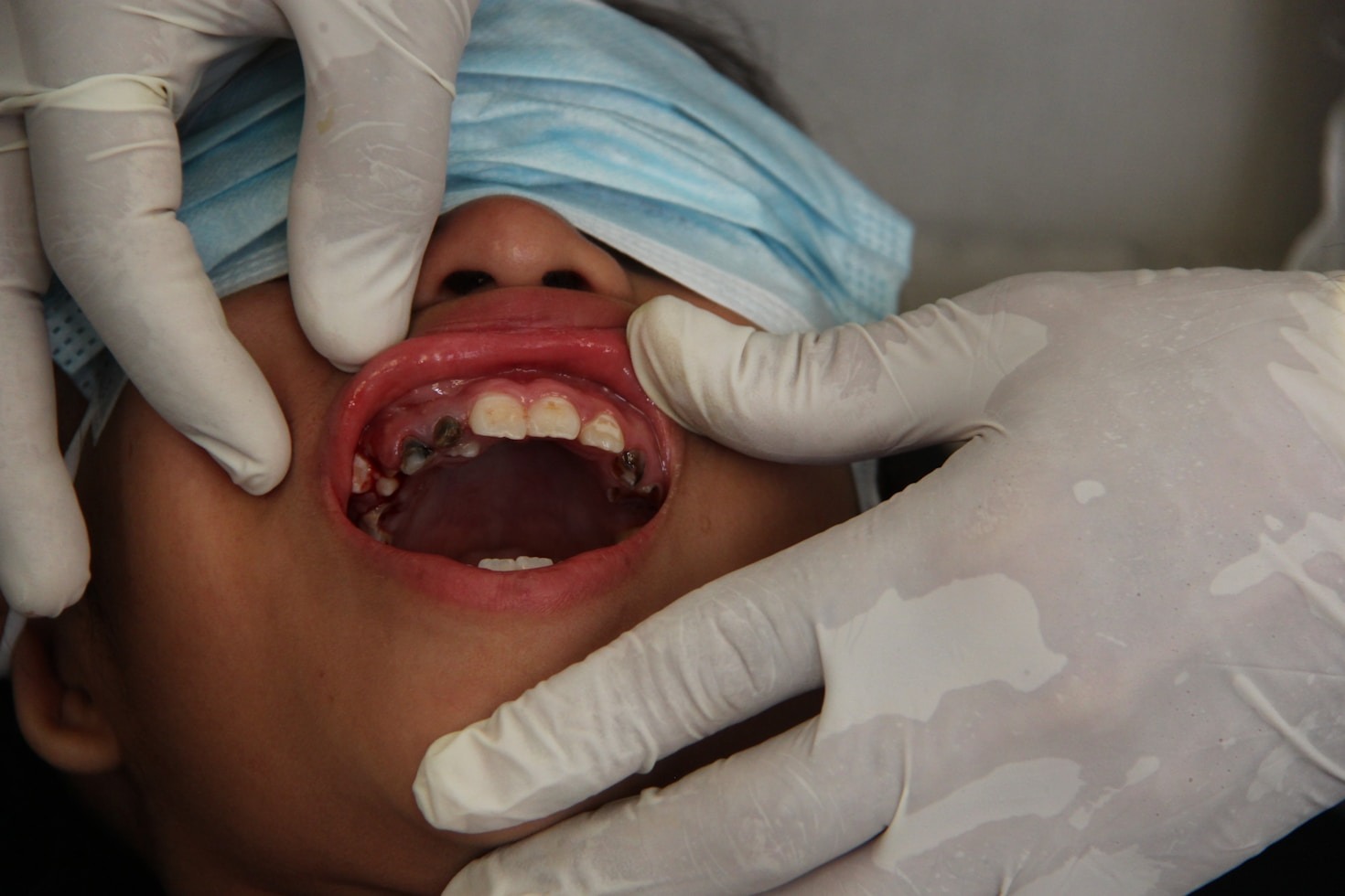 Las claves para entender los presupuestos dentales