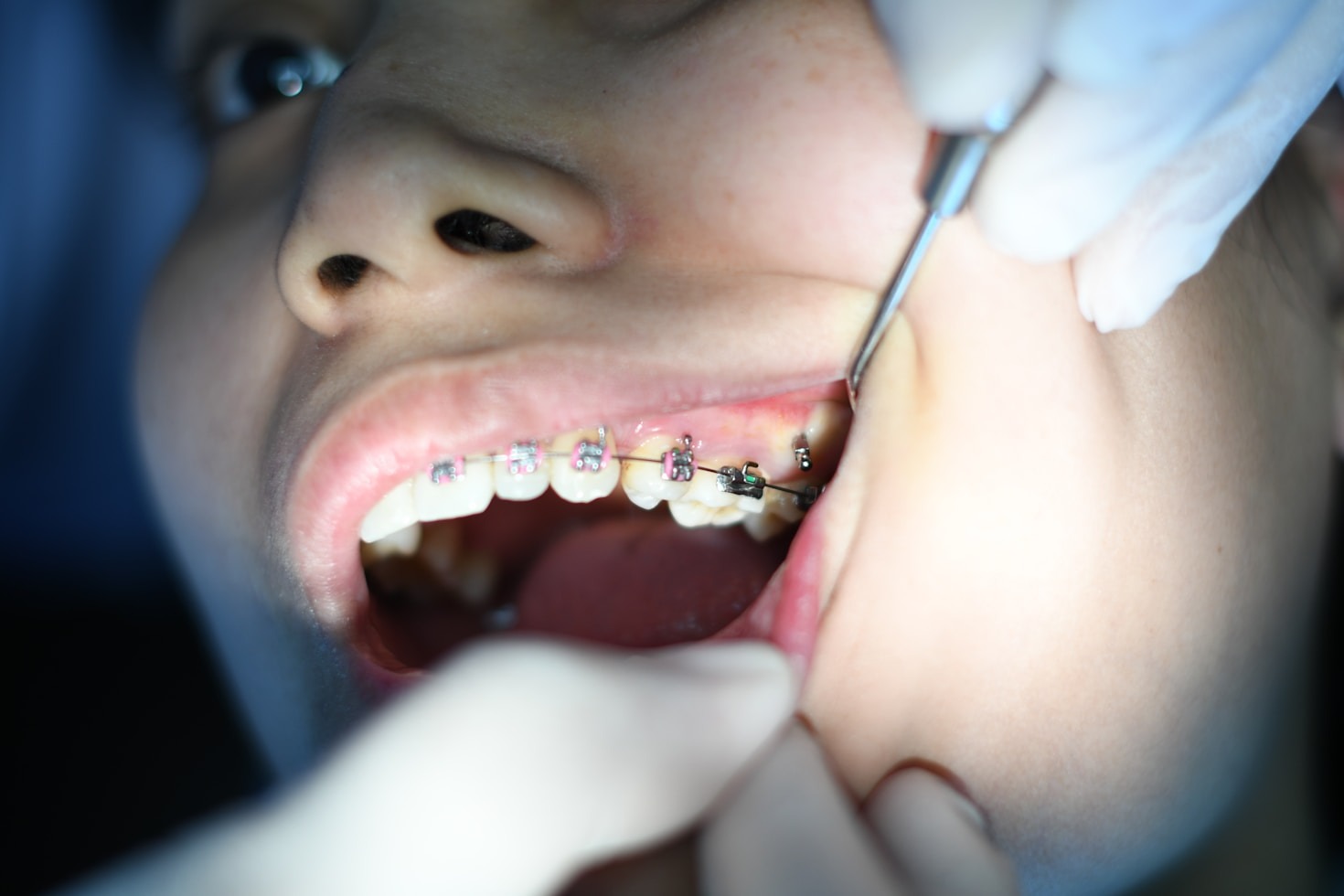 El impacto de una buena decisión dental
